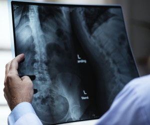 Cyberkriminelle könnten Röntgenbilder fälschen