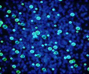 Mit KI Antibiotikaresistenzen schneller vorhersagen
