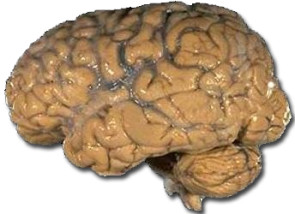 Human_brain_NIH.png 