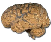 Human_brain_NIH.png