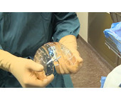 schaedel-implantat.jpg