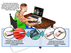 Darpa_Prothesen.jpg 