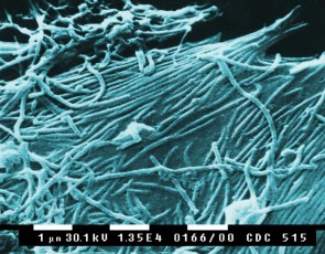 Ebola_Virus.jpg 
