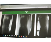 3D-Venen-Scanner-web.jpg